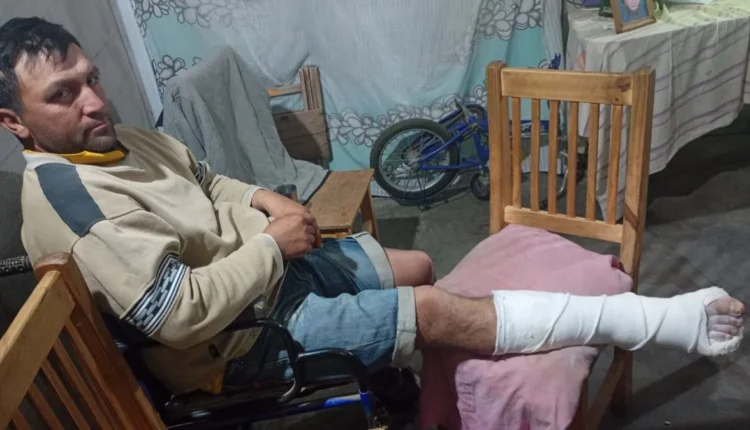 Un joven de Caucete sufrió una triple fractura de tobillo y su familia pide ayuda desesperada para financiar la cirugía
