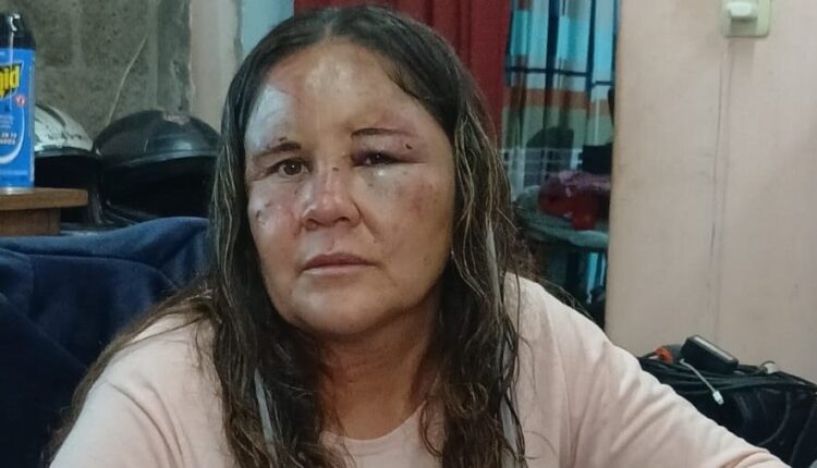 Calingasta: madre e hija deberán pagar una reparación económica por una violenta agresión
